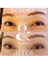 ジーニー(Genie)/アンドヘルシー140本