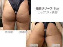 シェルサロン(Shell Salon)/ヒップアップ