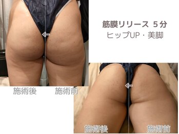 シェルサロン(Shell Salon)/ヒップアップ