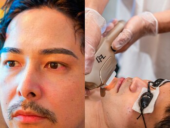 アトリウム オム 恵比寿店(ATRIUM HOMME)の写真/アイブロウも人気！光フェイシャルで脱毛後の肌ケアもできる♪メンズ顔脱毛で自信が持てる美肌に入れよう♪