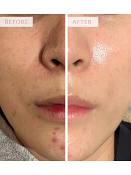 アンドニューリー(&NEWLY)/LDM×クリスティーナ