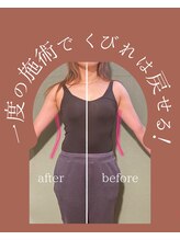 アコルデ(Acorde)/