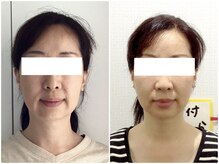 美容整体ウェリナ 名駅院/小顔矯正/骨盤矯正/美脚サロン