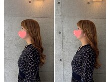 にゅうどうぐも(nyudougumo)/ビフォーアフター