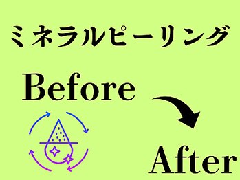ビースキン 広島(BE:SKIN)/ミネラルピーリング/ニキビケア