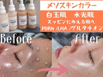 マールム(MALUM)の写真