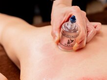 ビオルネ(VIE.ORNER)の雰囲気（吸引カッピングで筋肉の癒着を緩め、血流促進！代謝アップも期待）