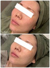 クラン 森ノ宮店(Clan)/20代、女性