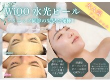 グレッシュ &nbsp;弘前店(Gresh)の雰囲気（水光ピールで美白透明感×みずみずしいツヤ水光肌へ！）