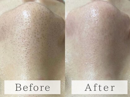 ルミラポー(Lumira Peau)の写真