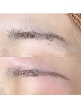 ツナミ(Tsunami)/眉毛脱毛