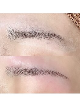 ツナミ(Tsunami)/眉毛脱毛