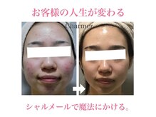 シャルメール 堀江(Charmer)の雰囲気（どこへ行ってもダメだった方へ。本気の肌質改善してみませんか？）