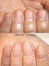 マリーロール 梅田店(Marie Laure)/深爪矯正/自爪育成/自爪風