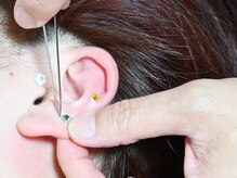 リリテ*エステヤ/イヤーエステ【4】