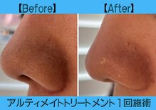 グラサヴォーグ 金沢店