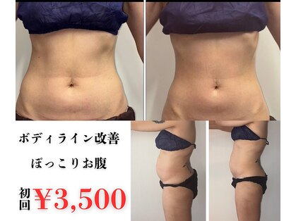 アイリーボーテ 東大阪(アイリーBEAUTE)の写真