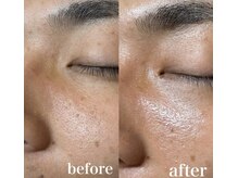 アイラッシュ シェリ(cheri)/ララピール