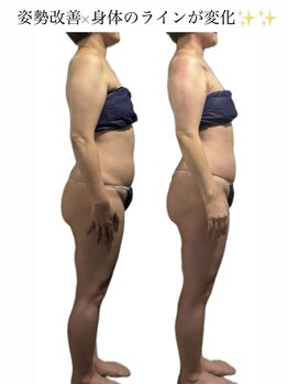 痩身革命 大宮店/筋膜リリース/リンパ/ダイエット