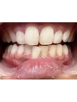 美白ケアをしたい