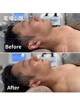 ハピネス 心斎橋アメリカ村本店(Happiness)/30代後半男性