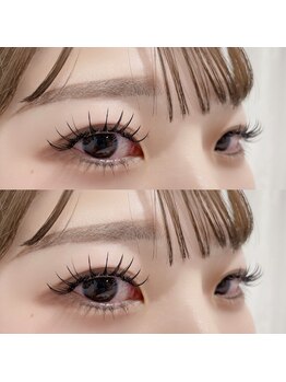 シヨン(Ciyon.)/&healthy