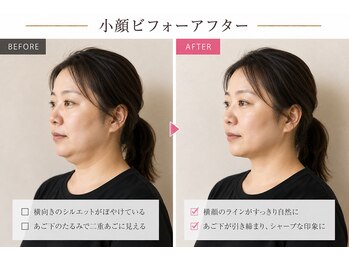 ベアフット(BARE FOOT)/40代から若見え姿勢へ