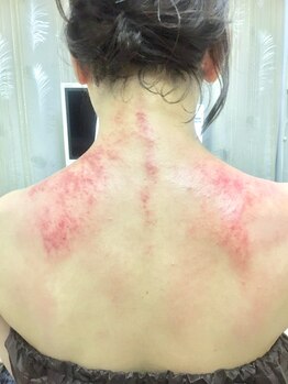 眠るひつじと深呼吸の写真/【台湾式かっさ+足つぼ】「老廃物」が目に見える?!肩~首~背中スッキリ軽く!首のつまりもとれ頭痛にも◎
