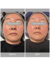 bou 新宿/あれ？痩せた？