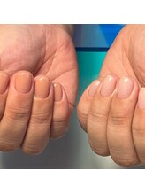 アルムネイル(ARUM nail)/