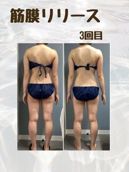 プリマプリート 可児店/筋膜リリースで全身ケア！