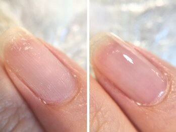 アッソ ネイル(asso nail)の写真/ささくれ,硬い甘皮,爪の縦筋,凹凸等...こんなお悩みがある方は是非サロンクオリティの爪ケア体験を☆