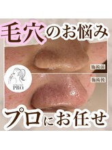 ミュウ(miuex)/お任せください！