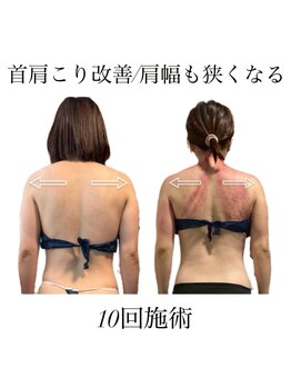痩身革命 大宮店/ダイエットリンパマッサージ