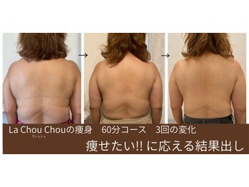 ラシュシュ(La chou chou)の写真/【結果出し痩身】上半身リンパ流しマッサージ★自信のある後ろ姿へ！機械×ハンドテクニックでWアプローチ