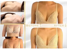 ファッシモ(fascimo)/バストアップ