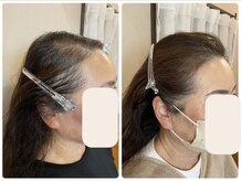 ウブジュール(Oeuf dur)の雰囲気(【頭皮ケア】分け目、トップのボリューム悩みに。髪が育つ実感を)