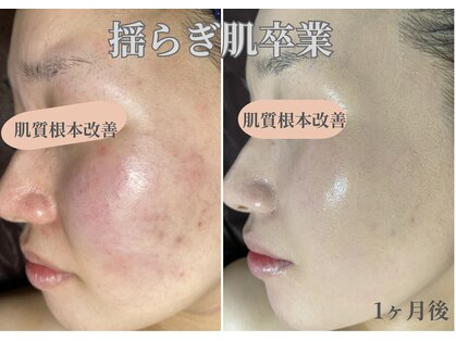 ルーチェ カリーノ(Luce Carino)の写真