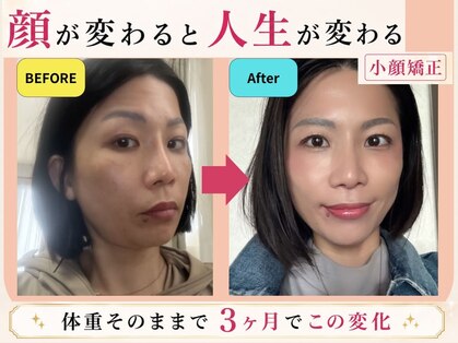 キッカ 岡山店(kikka)の写真