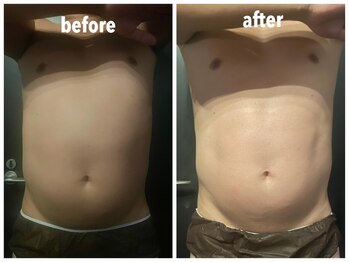 エイティスト(EiGHTiEST)/メンズ痩身