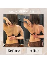 サロンドゥードゥー(SALON DOUDOU)/魅せる背中へ！