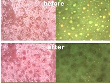 ベベ 金沢片町店(Be’be’)/その場で実感！ビフォーアフター