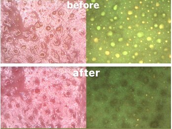 ベベ 金沢片町店(Be’be’)/その場で実感！ビフォーアフター