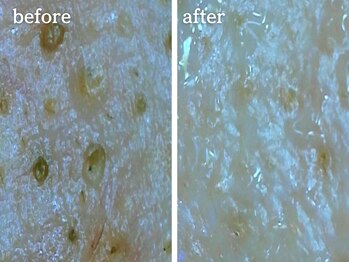 メルシア(merucia)/