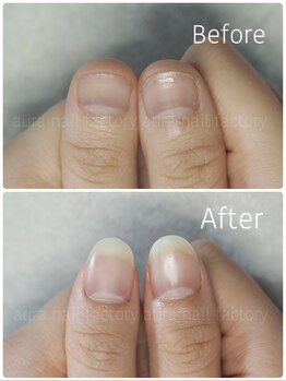 アウラ ネイル ファクトリー(aura nail factory)/深爪矯正スカルプ長さ出し自爪風
