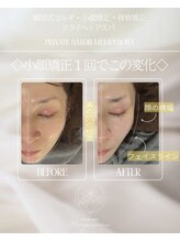 ムンプソナ(Mempesona)/小顔/骨格矯正/ヘッドスパ90分