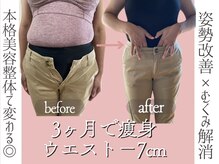 ロウズィエト(Roseate)の雰囲気（6回施術の変化）