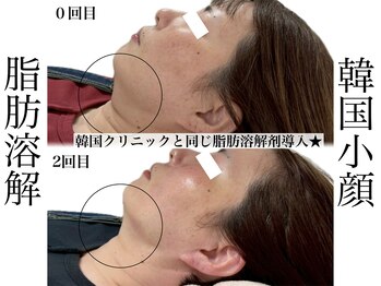 リベルキョウト 京都駅前店(Liber Kyoto)/レモンボトル超え!二重顎撃退