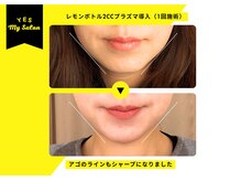 イエス マイサロン(yes My Salon)/レモンボトル施術例