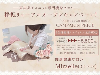ミラエル(Miraelle)の写真
